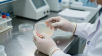 Candida Auris